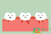 牙龈出血什么办法可以止血